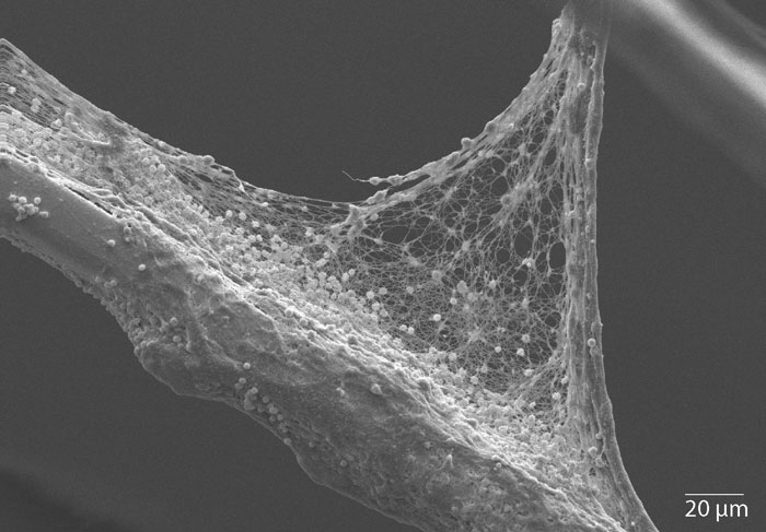 Lasergeschnittener Stent<br /> ohne HEAL Beschichtung